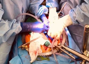 first time successful pig body graft for dead person 118443