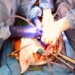 first time successful pig body graft for dead person 118443