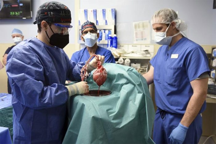Doctors at a hospital in Maryland have successfully performed the first pig heart transplant on a human.