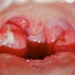golden rules to keep children safe from throat infection 120881