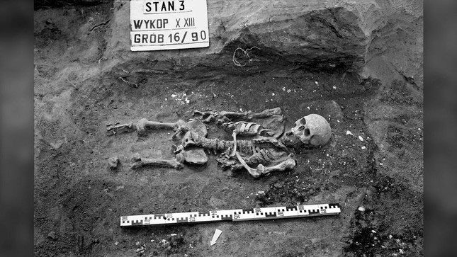 Remains of a medieval man suffering from two different forms of dwarfism.