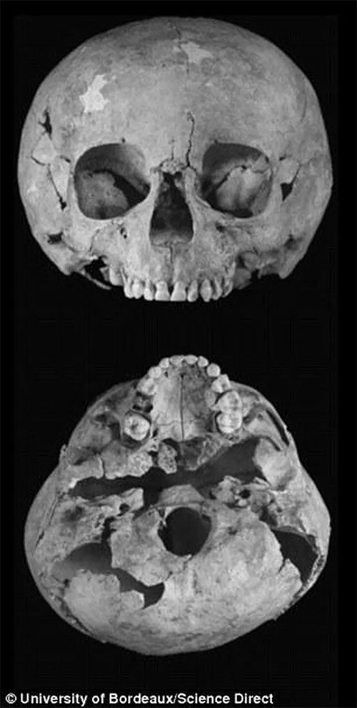 The skull of a 5-7 year old child recently found at the Saint-Jean-des-Vignes cemetery.