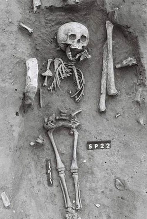The skeleton of a child showing signs of Down syndrome, discovered in France.