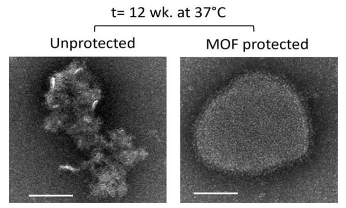 Electron microscope image of vaccine particles