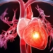 heart failure killed maradona how dangerous is it 109653