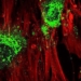 high frequency sound wave therapy stem cell regeneration in bone tissue in just 5 days 119644