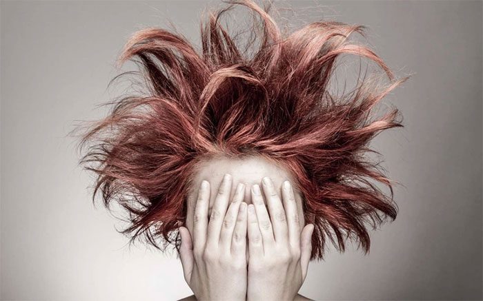 Currently, there is no specific treatment for uncombable hair syndrome