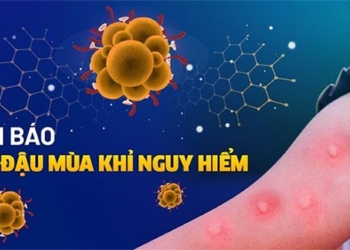 how are seasonal allergy and flu different 121028