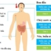 how to differentiate between flu and cold 122095