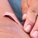 how to handle wounds with risk of infection in children 124272