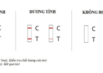 how to use and read results on covid 19 test kit 117953