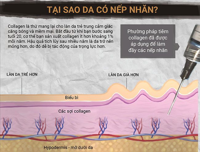 lao hoa 4