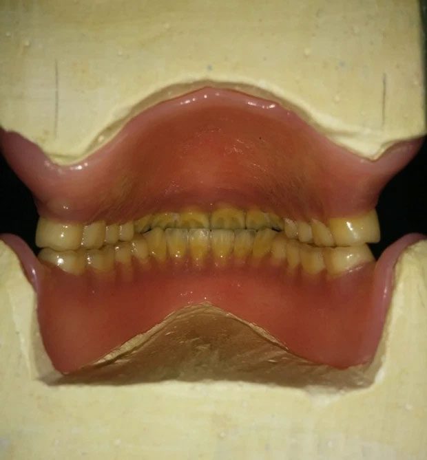 The back of a set of teeth