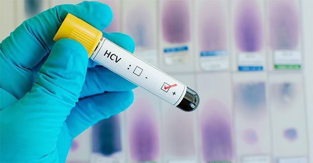 Hepatitis C affects 71 million people worldwide.