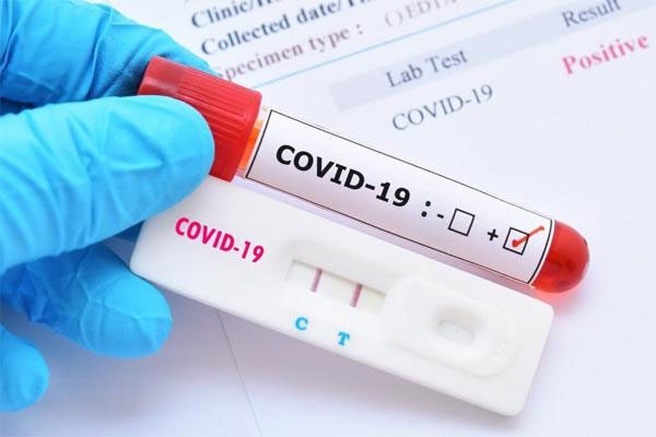 Scientists develop decoys to protect healthy cells from Covid-19