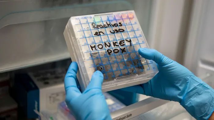 Monkeypox test samples at La Paz Hospital, Madrid, Spain.