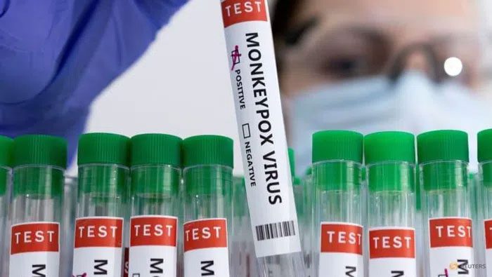 Test sample container for monkeypox virus.