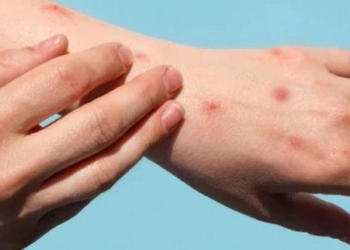 medical waste could cause virus outbreaks during the rainy season 120942