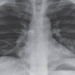 method to detect covid 19 positive individuals without testing 119330