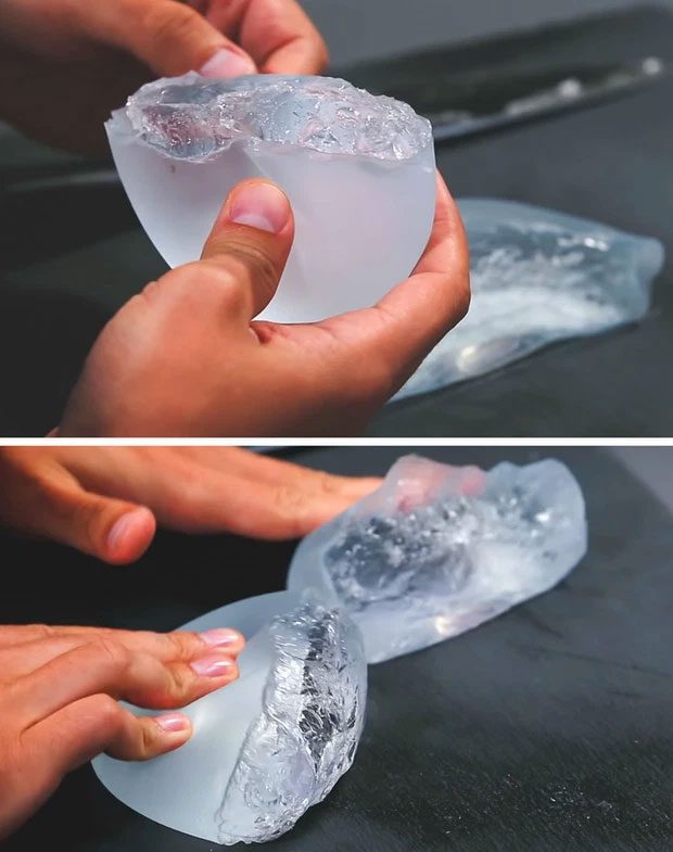 Silicone breast implant