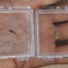 miniature robot creation assisting tumor treatment 119978