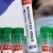 ministry of health guidelines on temporary measures to prevent seasonal flu 120723