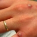 ministry of health issued guidelines for diagnosis treatment and prevention of seasonal flu 122034
