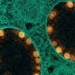 mosquito repellent drug prevents ncov in 8 hours 118275