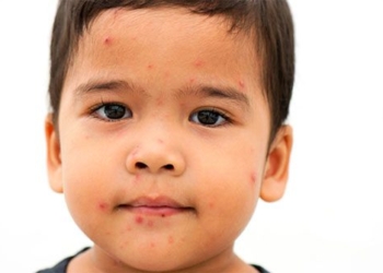 mysterious outbreak of belly ache in india 122481