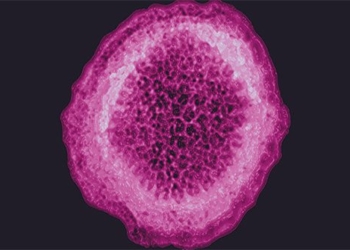 mysterious virus causing liver inflammation spreads to 11 countries first death reported 120187