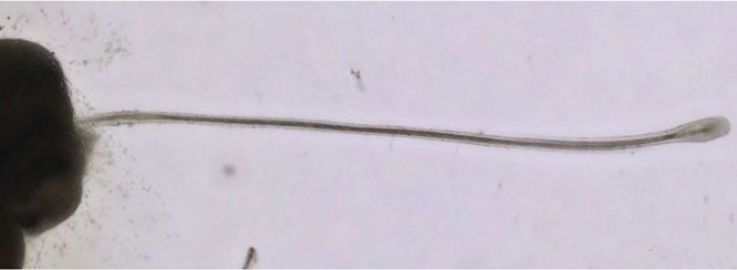 Hair developed from one of the cultured hair follicle organoids.
