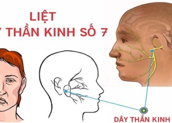 neu day than kinh so vii liet mat la gi 122125