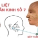neu day than kinh so vii liet mat la gi 122125