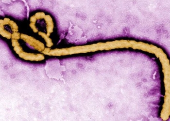 new discovery about virus that causes 25 90 people to die 118864
