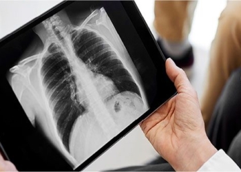 new discovery on the cause of lung cancer 122887