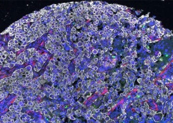 new drug beats cancer cell growth 122966