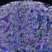 new drug beats cancer cell growth 122966