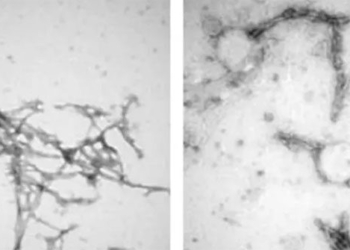 new method to prevent parkinsons using nano technology 122175