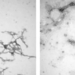 new method to prevent parkinsons using nano technology 122175