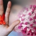 new super infectious strain of hiv discovered to be more aids like 118735
