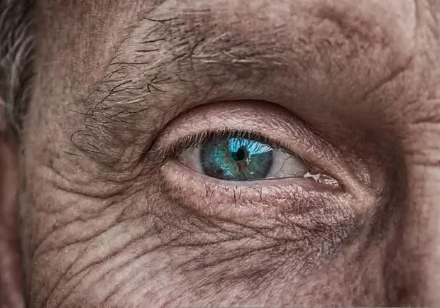 Blue eyes are a recessive gene, which is why only 8 to 10% of the world's population has blue eyes.