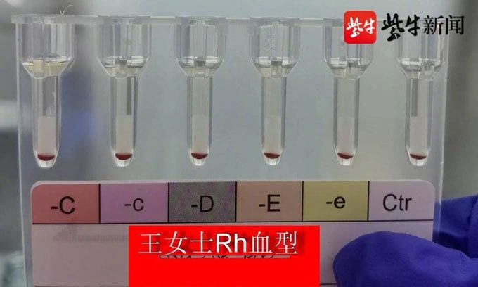 Rh-null is the rarest blood type in the world.