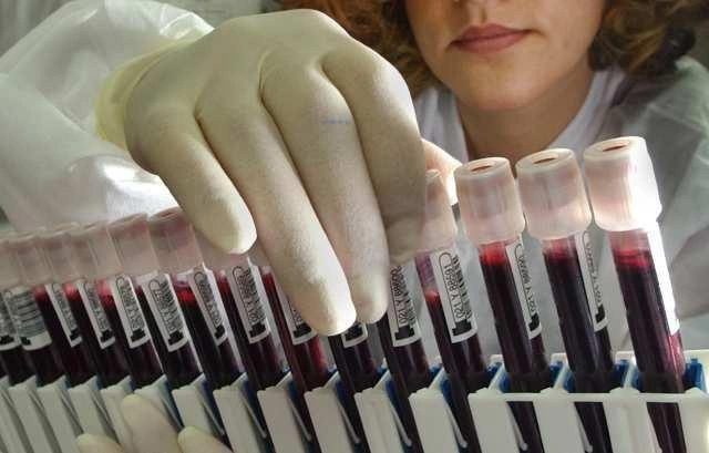 The new blood type contains 5 types of unusual antigens.