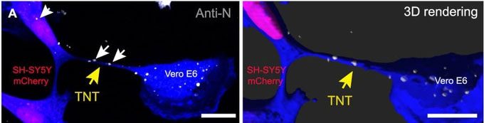 Infected Vero E6 cells co-cultured with SH-SY5Y cells.