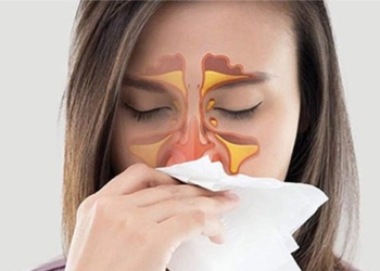 people with allergic rhinitis should avoid 2 foods and eat 3 foods to prevent worsening the condition 124104