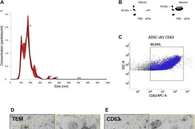 Analysis of the aging process in mice after injecting EVs into older mice.