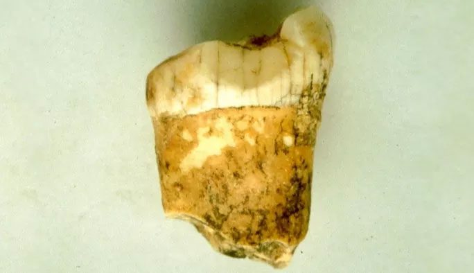 The Neanderthal tooth revealed the truth that they were at the top of the food chain