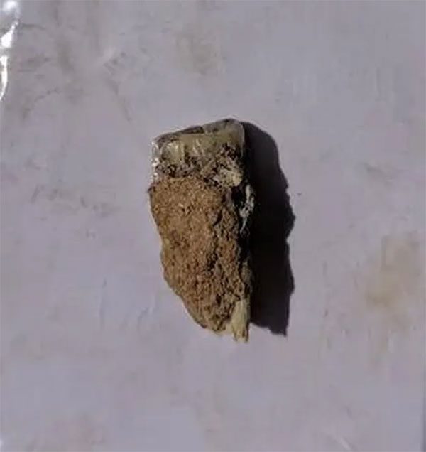 The 1.8 million-year-old tooth found in Georgia