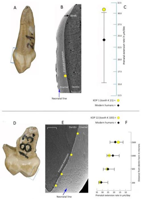 Neanderthal child's milk tooth.