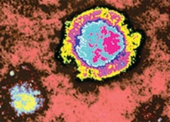 rare virus causing near 100 deaths unexpectedly reappears 121084